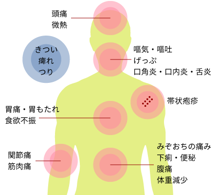 消化器内科・ペイン