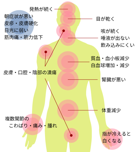 リウマチ・膠原病内科